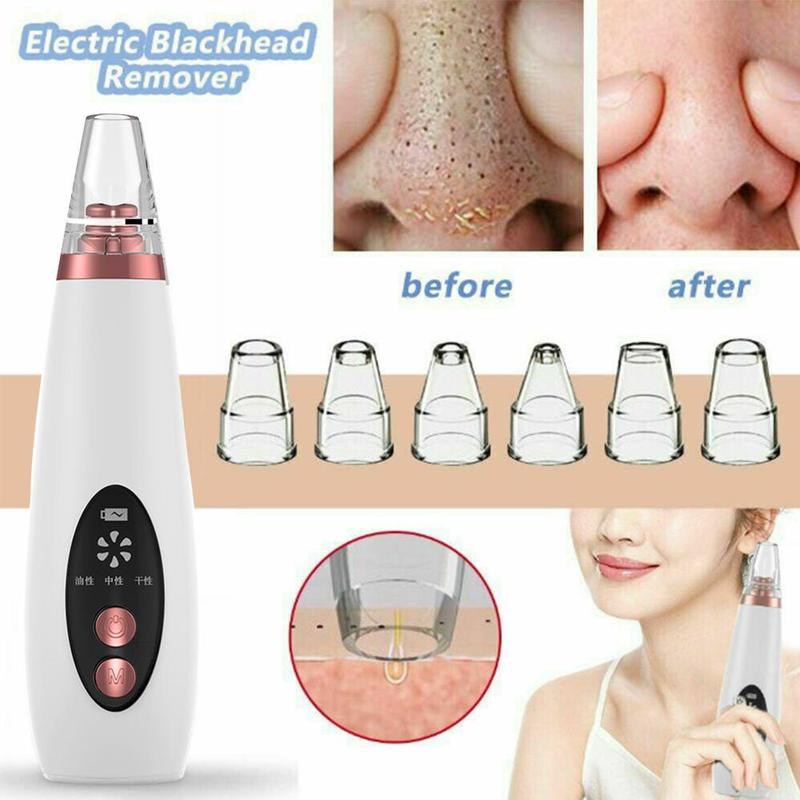 USB Blackhead Black Dot Remover Face Pore Vacuum Skin Care Acne Pore Cleaner Pimple Removal Vacuum Suction Facial Tools